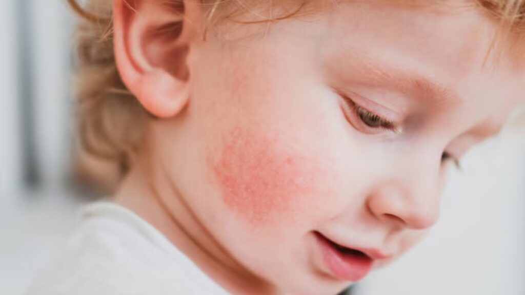vitamin a deficiency effects on autistic children